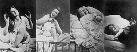 Women under Hysteria, <i>1876-1880</i>, by D.M. Bourneville and P. Régnard. Hysteria profoundly shaped 19th-century French literature and art, inspiring explorations of psychological duality, the unconscious, and altered states of consciousness.