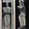 The Strand Statues for the British Medical Association, London (1907-08)