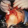The Reincarnation of Sainte-ORLAN (1990-93)