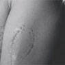 Vito Acconci: Trademarks (1970)